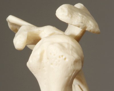 Foto: Schulterschmerzen entstehen häufig an der Rotatorenmanschette.