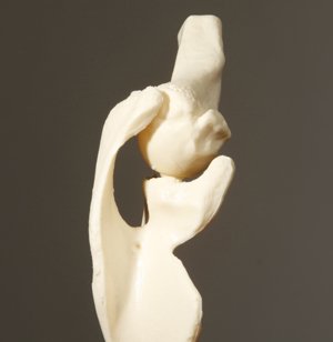 Foto:Schulterschmerzen behandeln wir in Köln mit einem ganzheitlichen Therapiekonzept.