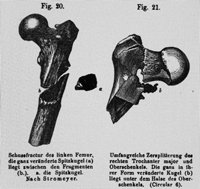 Die Orthopädie hatte immer schlimmere Wunden und knöcherne Verletzungen zu versorgen.